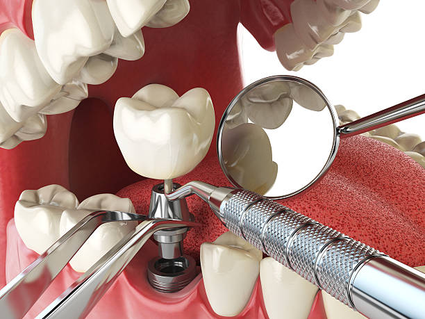Best Knocked-Out Tooth Emergency  in Cave Creek, AZ
